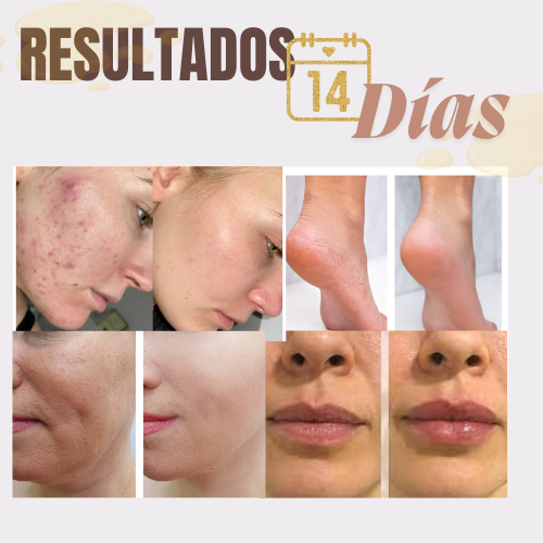 EVIL GOODS - Bálsamo Reparador, Reduce las imperfecciones del rostro e hidrata. Producto Original